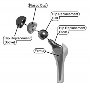 ~ Mechanical Joint-Implant Images – Hip and Knee Handbook of Joint ...